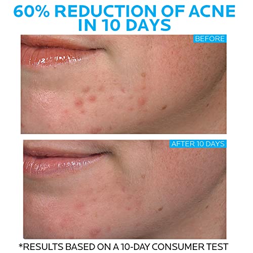 La Roche-Posay Effaclar Duo Dual Action Acne Spot Treatment Cream with Benzoyl Peroxide Acne Treatment, Blemish Cream for Acne and Blackheads, Safe For Sensitive Skin, 1.35 Fl Oz (Pack of 1)