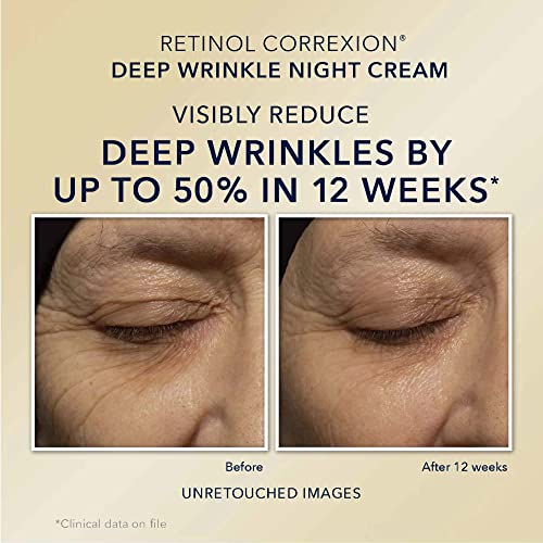 RoC Retinol Correxion Value Set Duo, Deep Wrinkle Anti-Aging Night Face Cream (10 fl oz) + Daily Under Eye Cream for Dark Circles & Puffiness (.5 fl oz), Skin Care Set (Packaging May Vary)