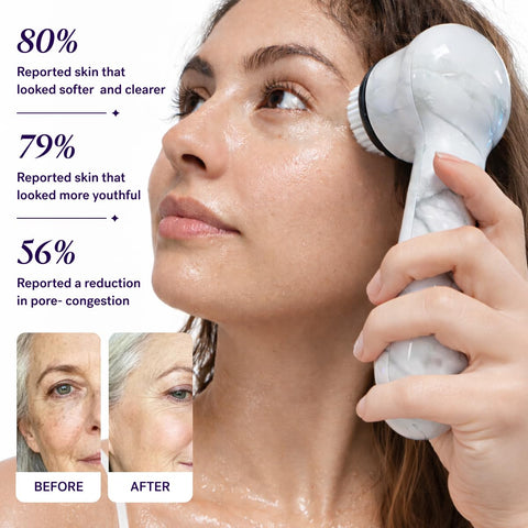 Michael Todd Beauty Soniclear Face Brush 2026 Allure Readers Choice Winner