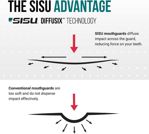 SISU Aero Medium Mouthguard, Lucky Lavender - 30% Stronger Protection for Lacrosse, Football, Hockey, Roller Derby, Team Sports - Remoldable Up to 20 Times - Ultra Slim - Works for Braces - Non Toxic