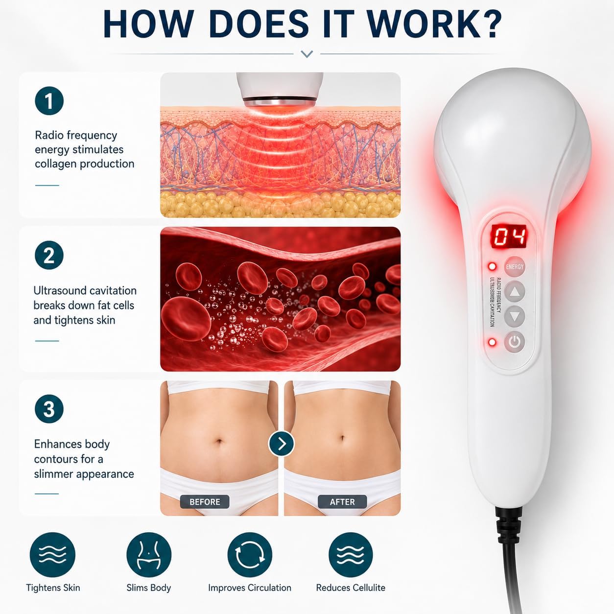 Radio Frequency Induced Heat-Palm NRG Cellulite Body Device
