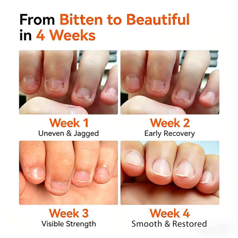 Modelones Nail Biting Prevention for Kids Quick Dry Thumb Sucking Deterrent