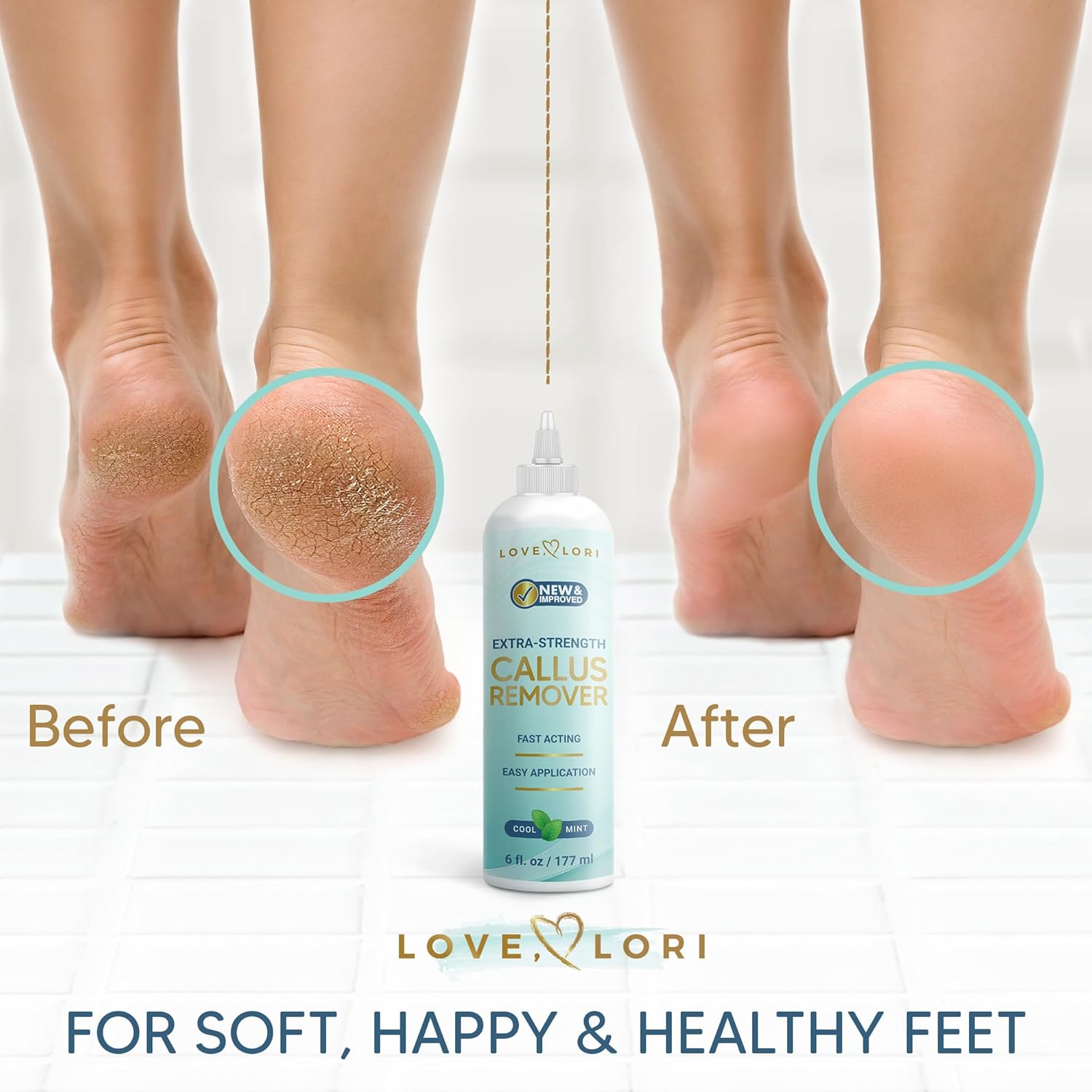 Love Lori Foot Callus Remover Gel Extra Strength Pedicure Tool for Feet 6oz