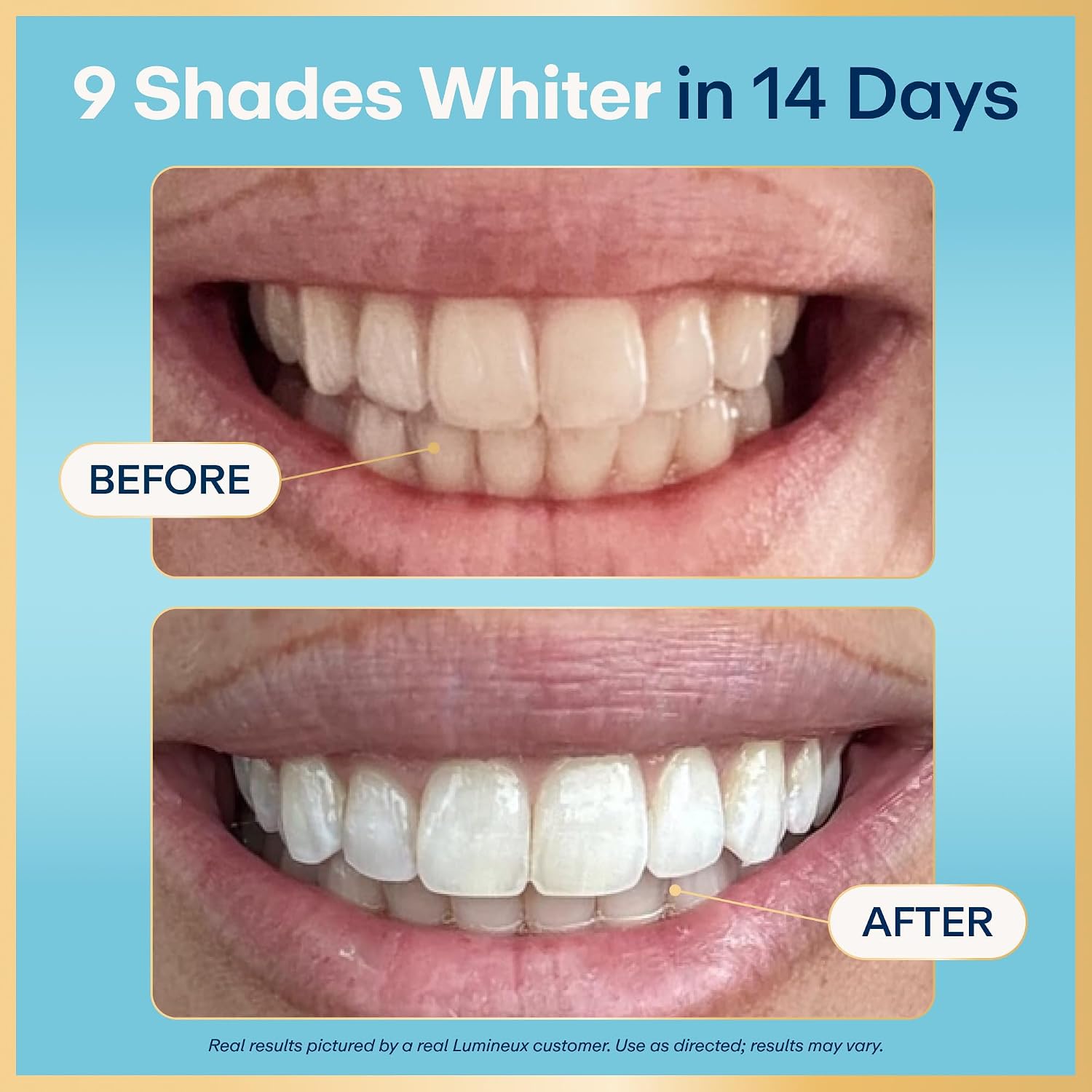 Lumineux Teeth Whitening Strips, Peroxide Free, 9 Treatments (1 Month)
