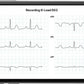 KardiaMobile 6-Lead Personal EKG Monitor – Six Views of The Heart – Detects AFib and Irregular Arrhythmias – Instant Results in 30 seconds – Works with Most Smartphones - FSA/HSA Eligible