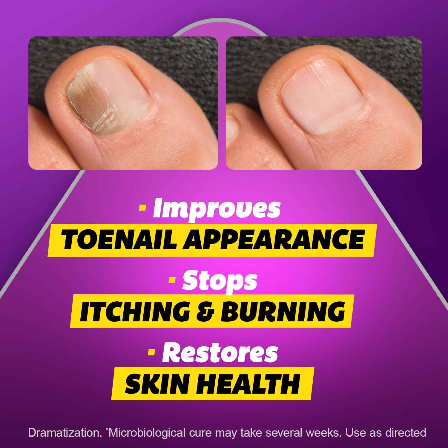 SILKA Max Strength Antifungal Liquid for Toenail Health with Brush Applicator, Results in 1 Week, Nail Fungus Treatment for Damaged Toenails, Athlete's Foot Treatment, Tolnaftate 1% 0.45 Fl Oz -3 Pack