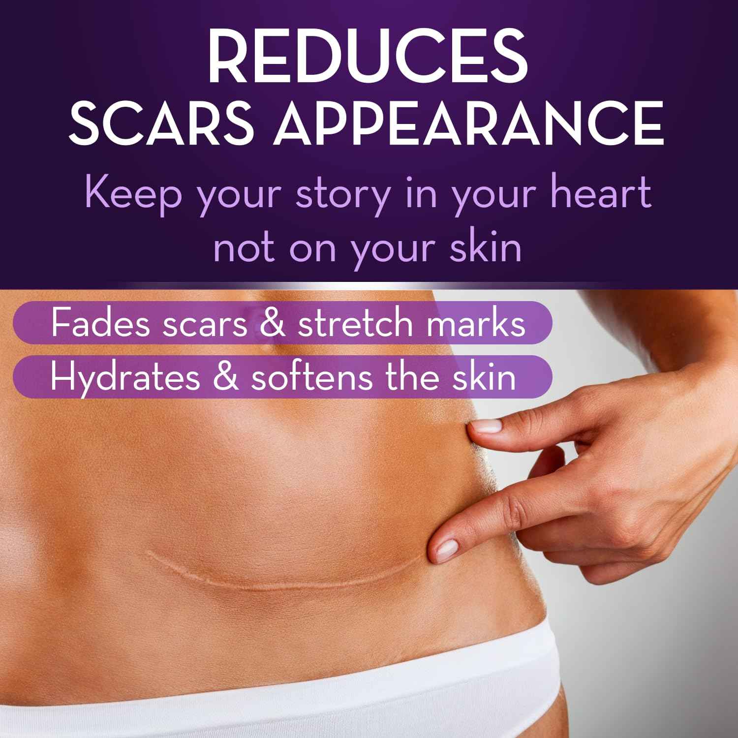 Cicatricure Advanced Scar Gel, Proven Results in 2 Weeks, 1 oz (28 g), 3pk | Scar Gel for Face & Body, Scar Treatment for Surgical Scars, Stretch Marks, Scars of Burns and Injuries, Acne Scar Treatment