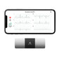 KardiaMobile 6-Lead Personal EKG Monitor – Six Views of The Heart – Detects AFib and Irregular Arrhythmias – Instant Results in 30 seconds – Works with Most Smartphones - FSA/HSA Eligible