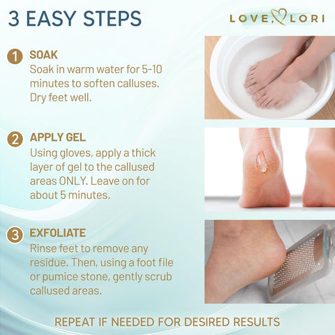 Love Lori Foot Callus Remover Gel Extra Strength Pedicure Tool for Feet 6oz