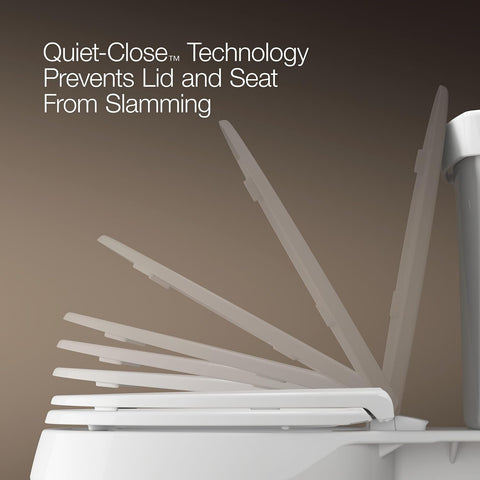 KOHLER 25875-0 Hyten 3" Height, Elevated Soft Close Elongated Toilet Seat, Contoured Seat with Grip-Tight Bumpers, Quick-Attach Hardware, No Slam Toilet Seat, White
