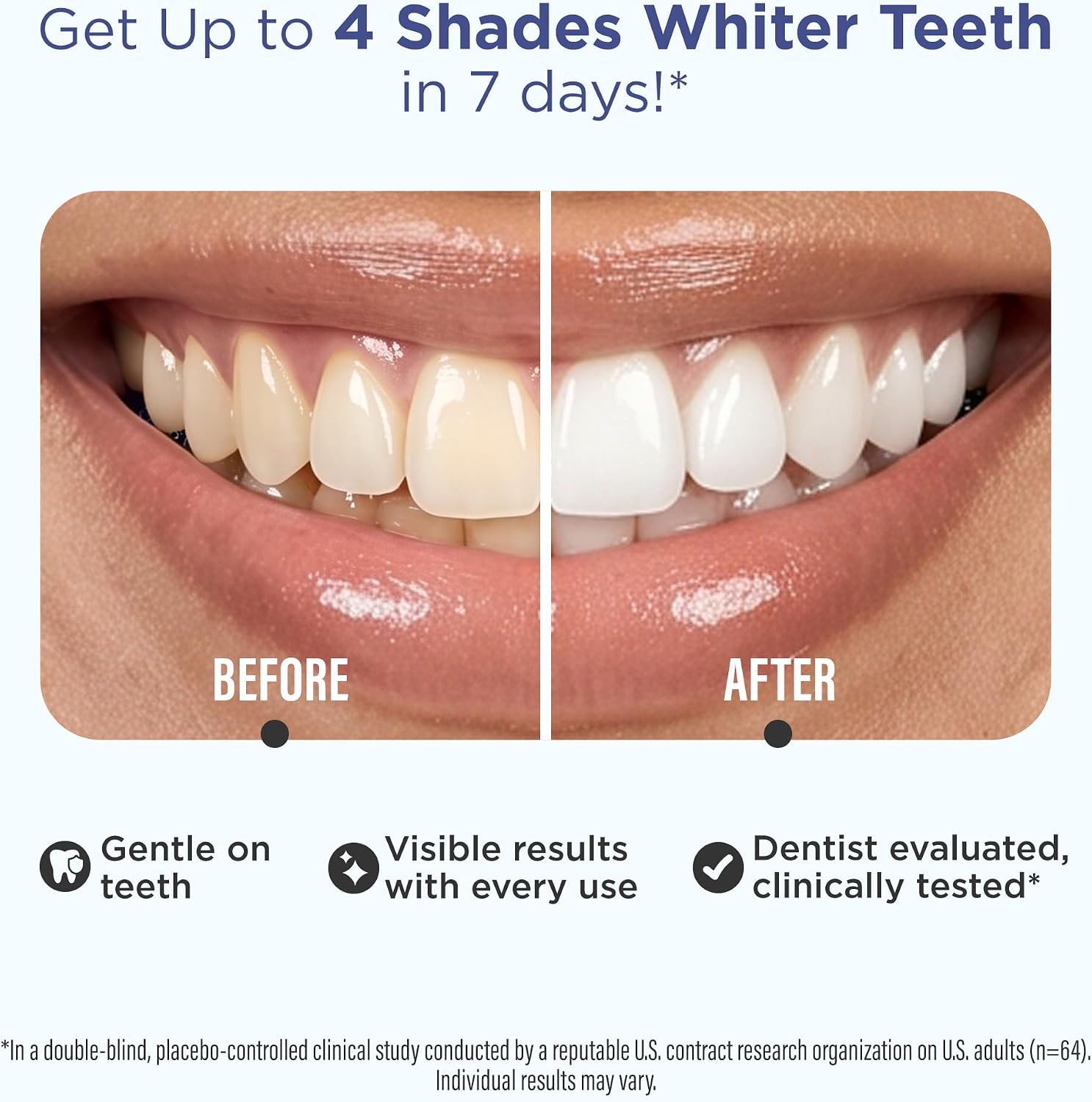 GuruNanda Teeth Whitening Strips - 4X Whiter Teeth, 7-Day Whitening Kit