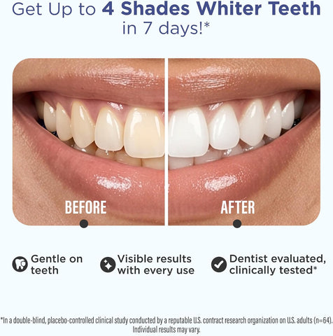 GuruNanda Teeth Whitening Strips - 4X Whiter Teeth, 7-Day Whitening Kit