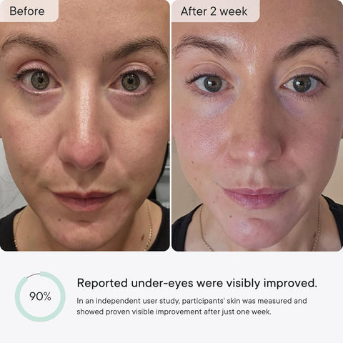 Qure Micro-Infusion Under Eye Patches for Wrinkles, Puffiness, Smile Line and Eye Bags - Retinol, Caffeine & Peptides - Made in Korea - Overnight Care, 8 Pairs (1 Month Supply)