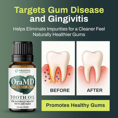 OraMD 4-in-1 Extra Strength Tooth Oil - Max Gum Disease Treatment (3 Pack)