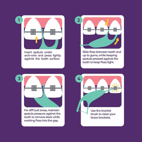 Platypus Orthodontic Flossers for Braces, 30 Count (Pack of 4)
