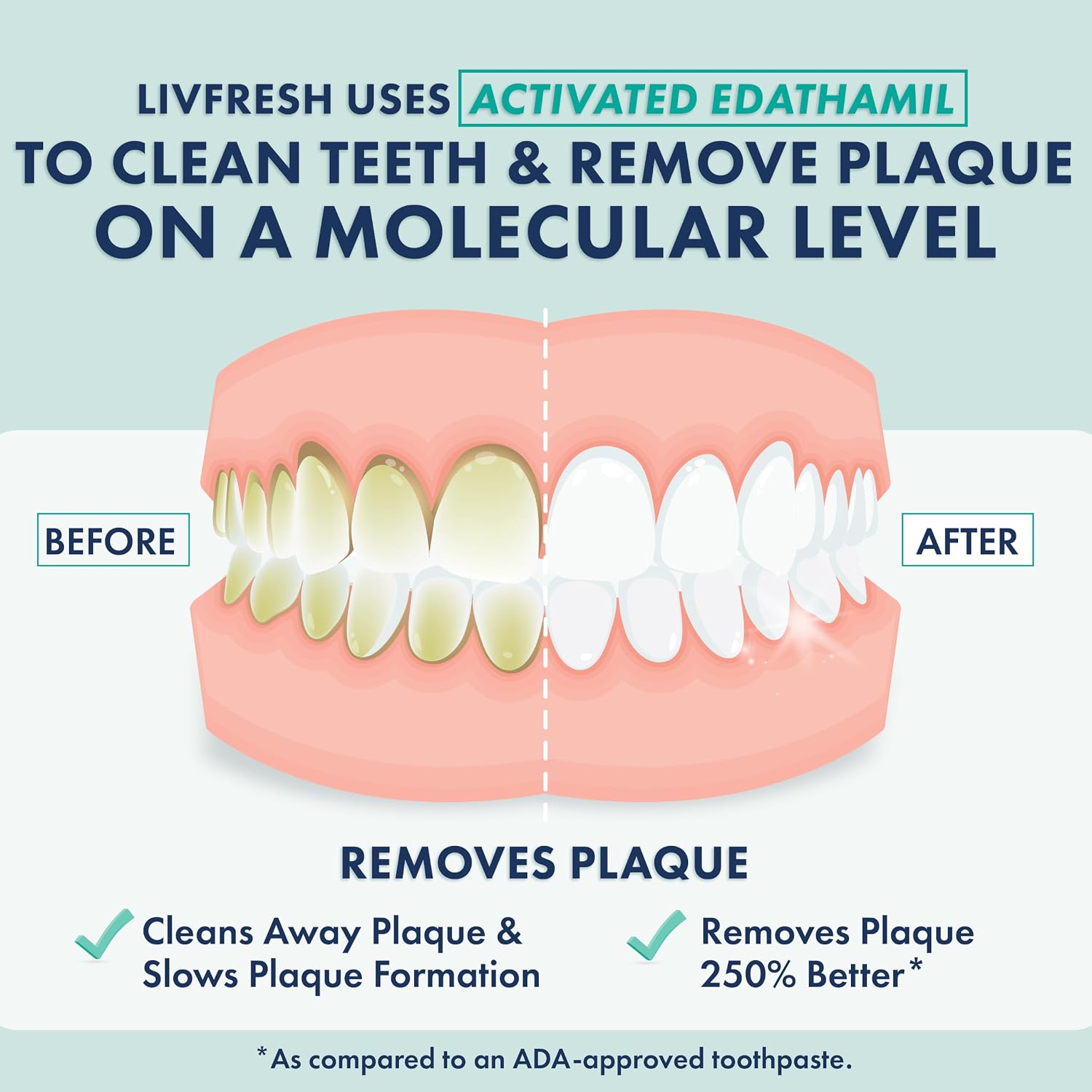 LIVFRESH Toothpaste Gel, Clinically Proven to Remove Plaque 250% Better, Does Not Irritate Gums, Reduces Tartar Buildup, Freshens Breath, SLS Free Dental Gel, Wintergreen