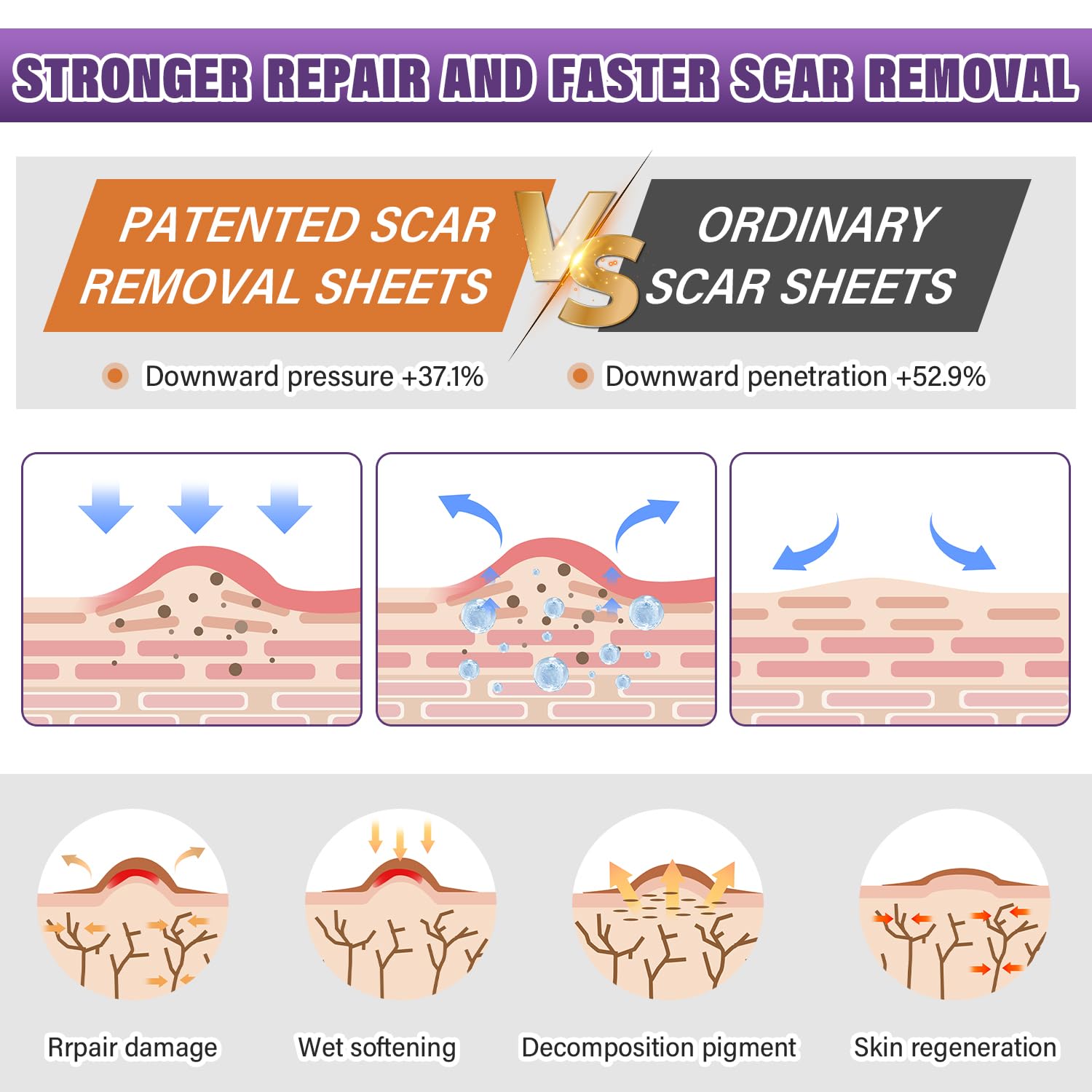 Silicone Scar Sheets, Medical Grade Silicone Scar Tape for Old & New Scars