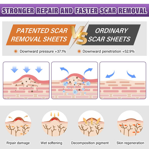 Silicone Scar Sheets, Medical Grade Silicone Scar Tape for Old & New Scars