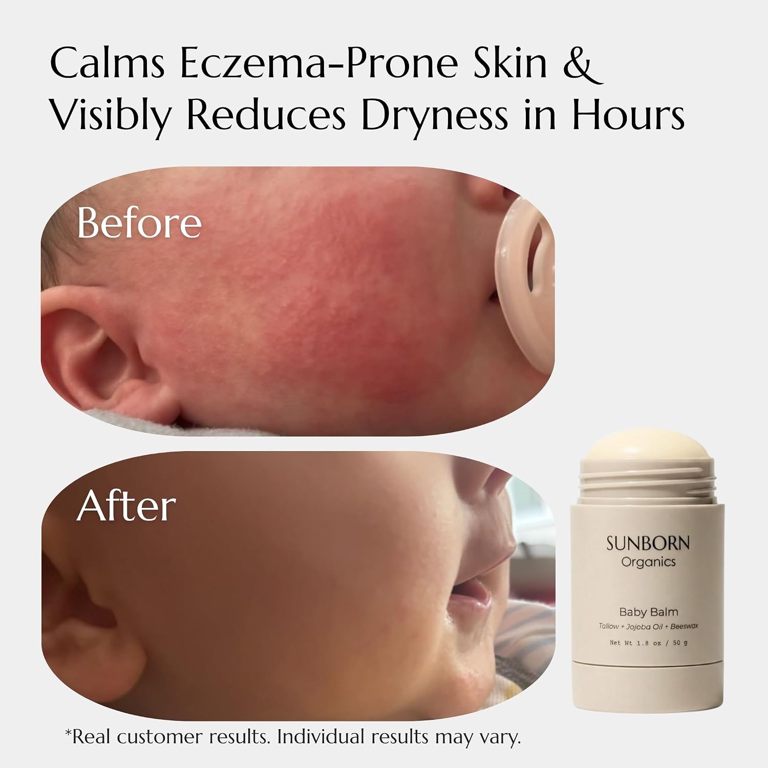 Baby Balm | 3 Natural Ingredient Moisturizing Stick for Eczema Relief, Sensitive Skin & Diaper Rash | Grass-Fed Tallow, Organic Jojoba & Beeswax | Lab Tested Baby-Safe, Made in USA