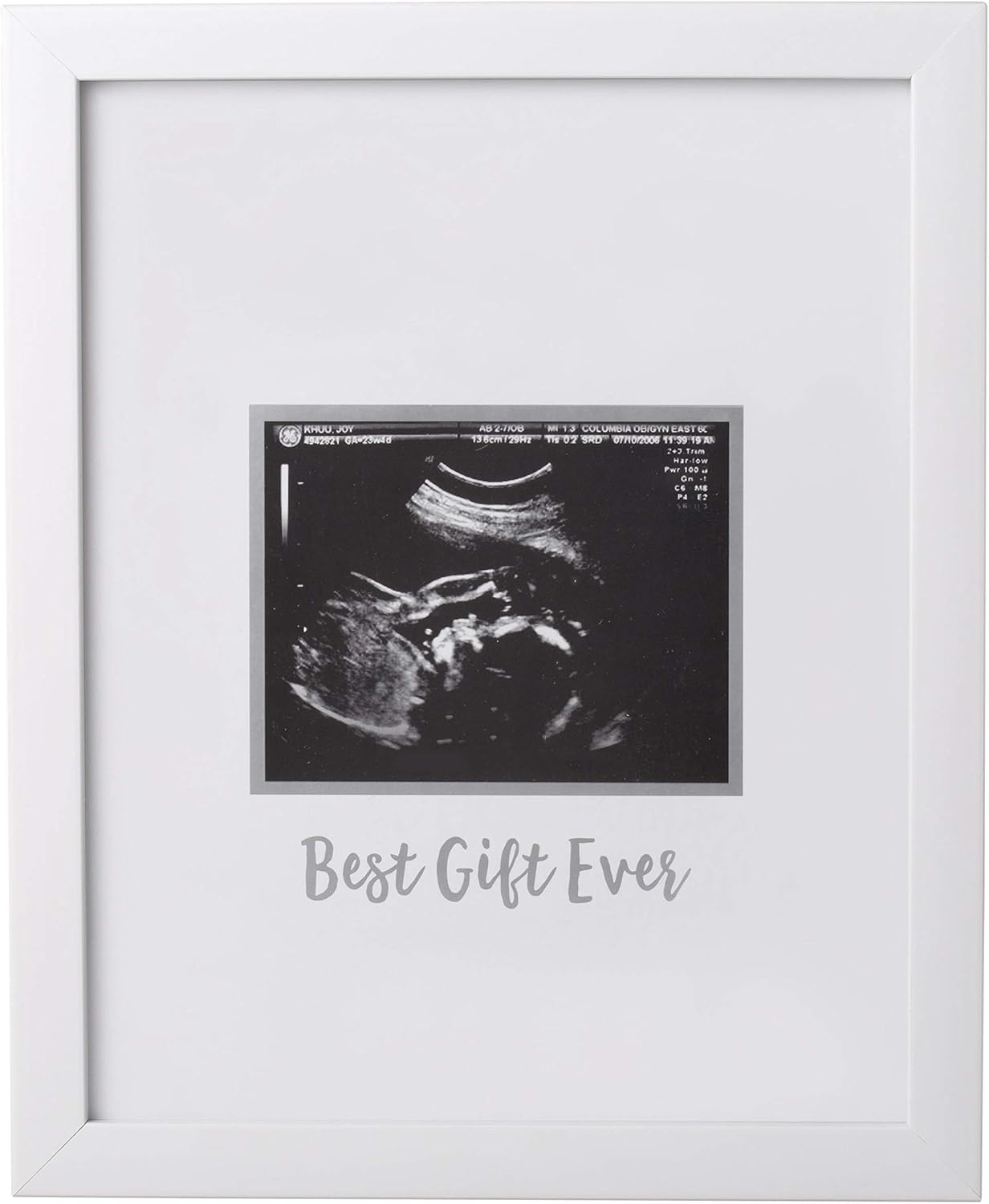 Guest Signature Sonogram Keepsake Frame