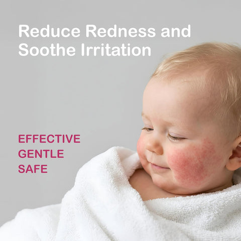 Hypochlorous Acid Spray Baby + Kids; Baby Skin Repair, Hand Cleanser | 8 oz