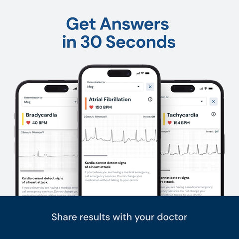 KardiaMobile 1-Lead EKG Monitor, Medical-Grade FDA-Cleared Personal Heart Monitor, Detects Normal, AFib & Arrhythmias, 30 Second Results, Works with Most Smartphones, HSA&FSA Eligible