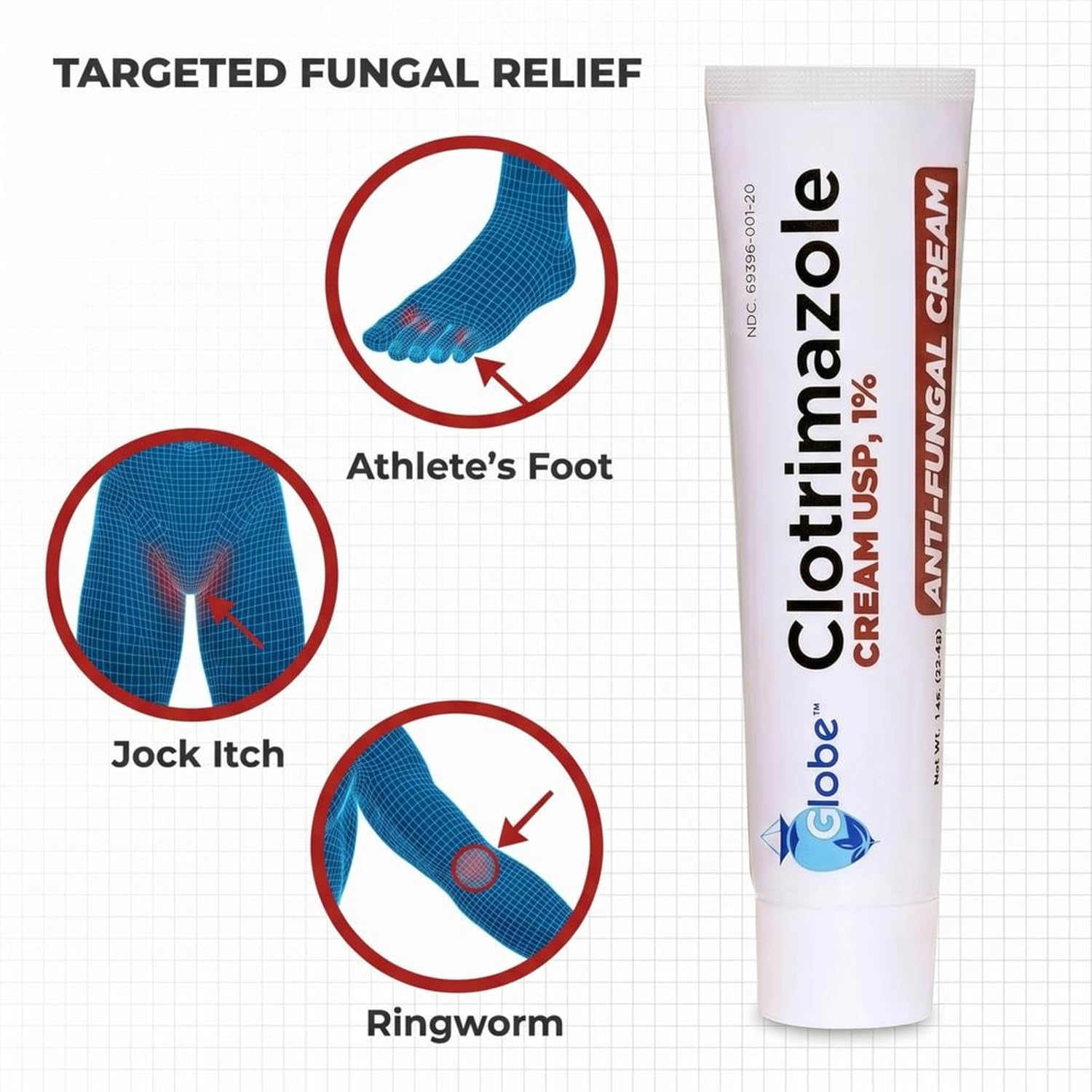 Globe Clotrimazole Cream 1% Antifungal Itch Relief Treatment, 1 oz Tube