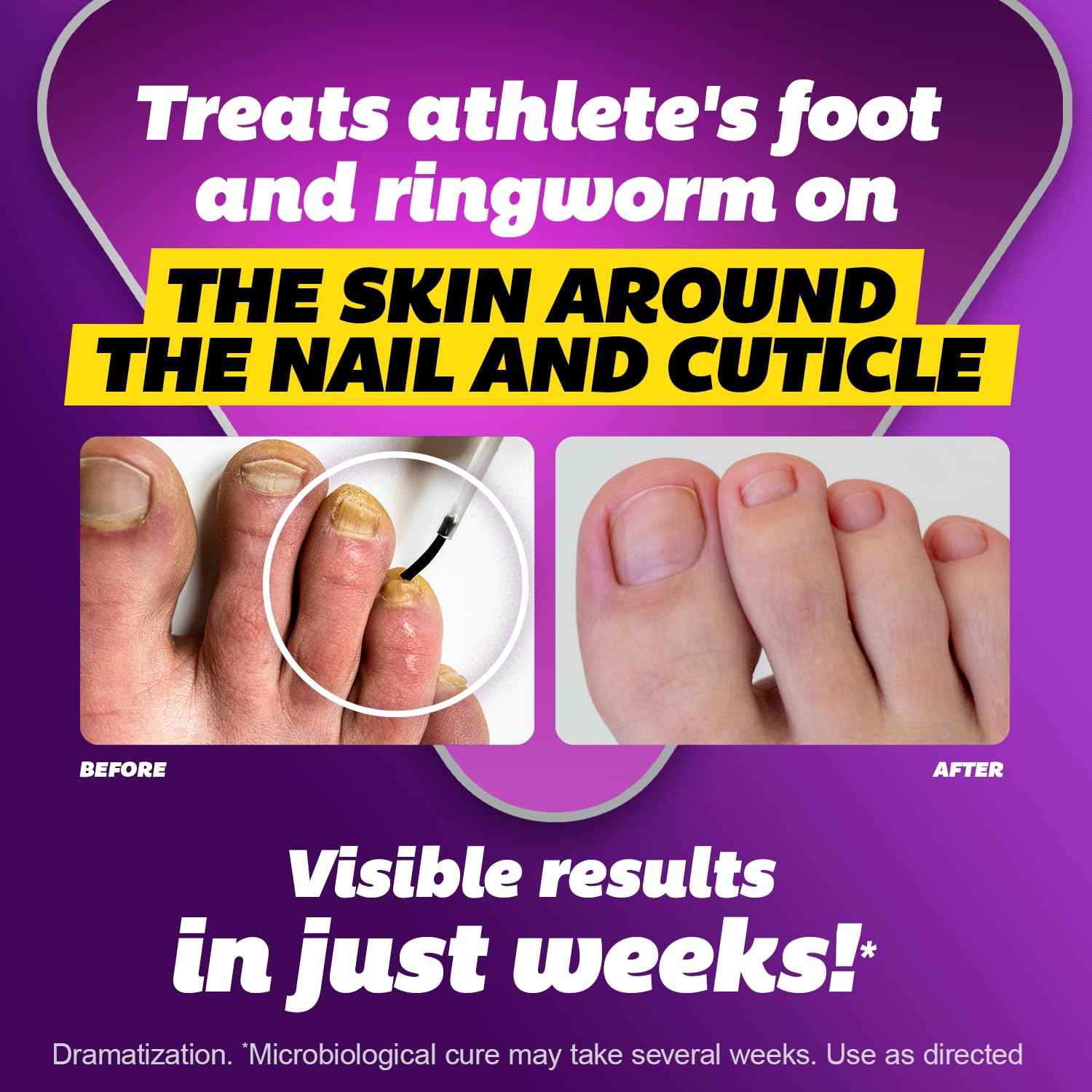 SILKA Max Strength Antifungal Liquid for Toenail Health with Brush Applicator, Results in 1 Week, Nail Fungus Treatment for Damaged Toenails, Athlete's Foot Treatment, Tolnaftate 1% 0.45 Fl Oz -3 Pack