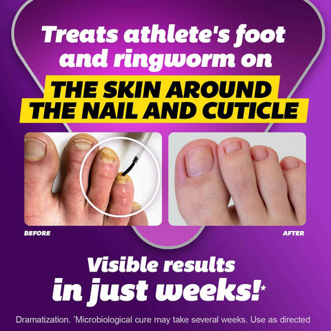 SILKA Max Strength Antifungal Liquid for Toenail Health with Brush Applicator, Results in 1 Week, Nail Fungus Treatment for Damaged Toenails, Athlete's Foot Treatment, Tolnaftate 1% 0.45 Fl Oz -3 Pack