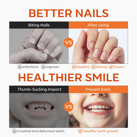 Modelones Nail Biting Prevention for Kids Quick Dry Thumb Sucking Deterrent