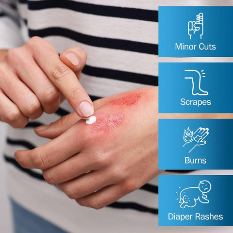 Zinc Oxide Ointment for Adults and Babies - 2 oz Diaper Rash Ointment - Skin Protectant for Diaper Rashes, Cuts, and Burns - 20% Zinc Oxide