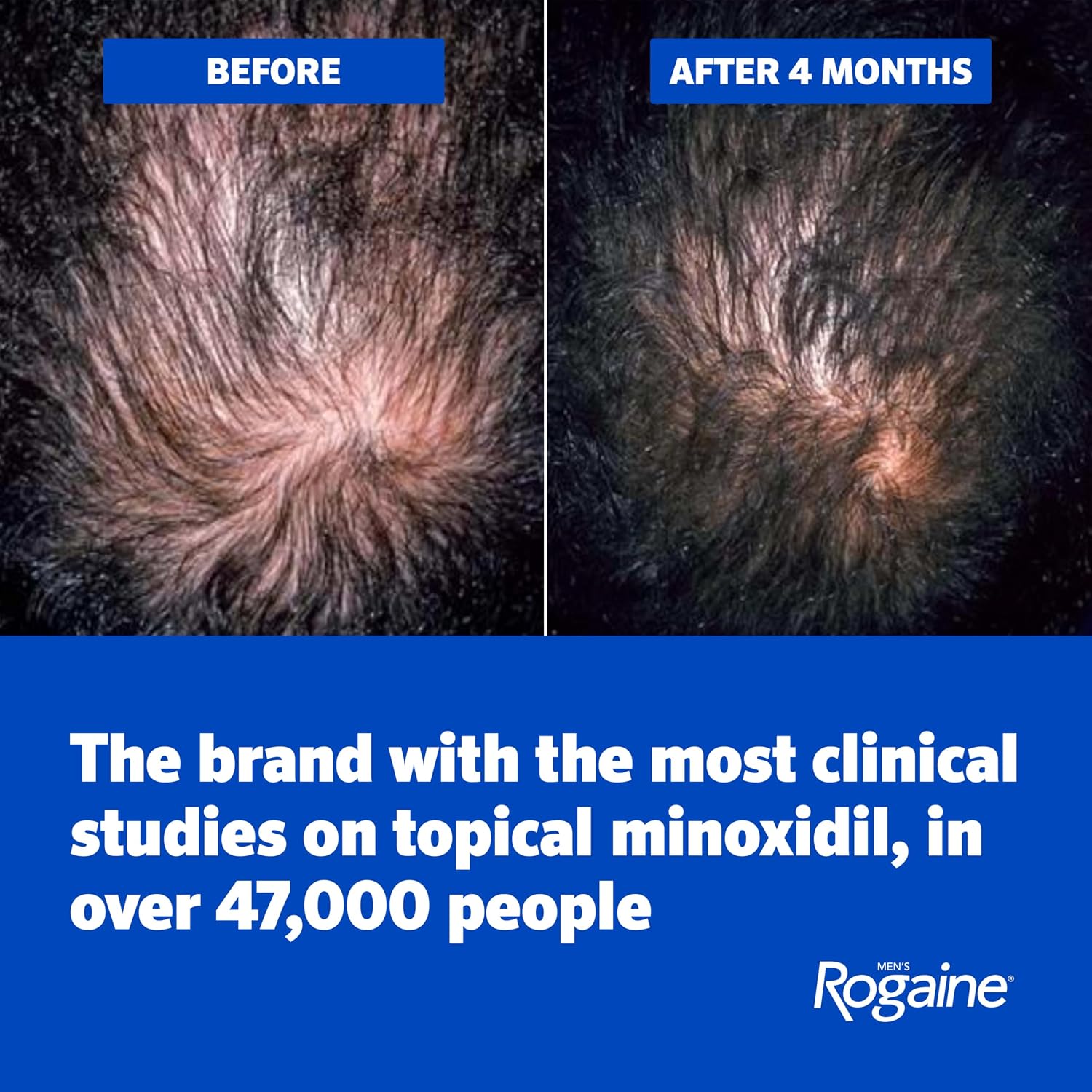 Men's Rogaine Extra Strength 5% Minoxidil Topical Solution, 3 x 2 fl. oz