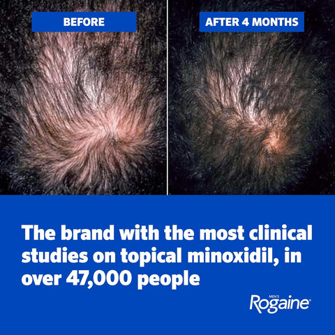 Men's Rogaine Extra Strength 5% Minoxidil Topical Solution, 3 x 2 fl. oz