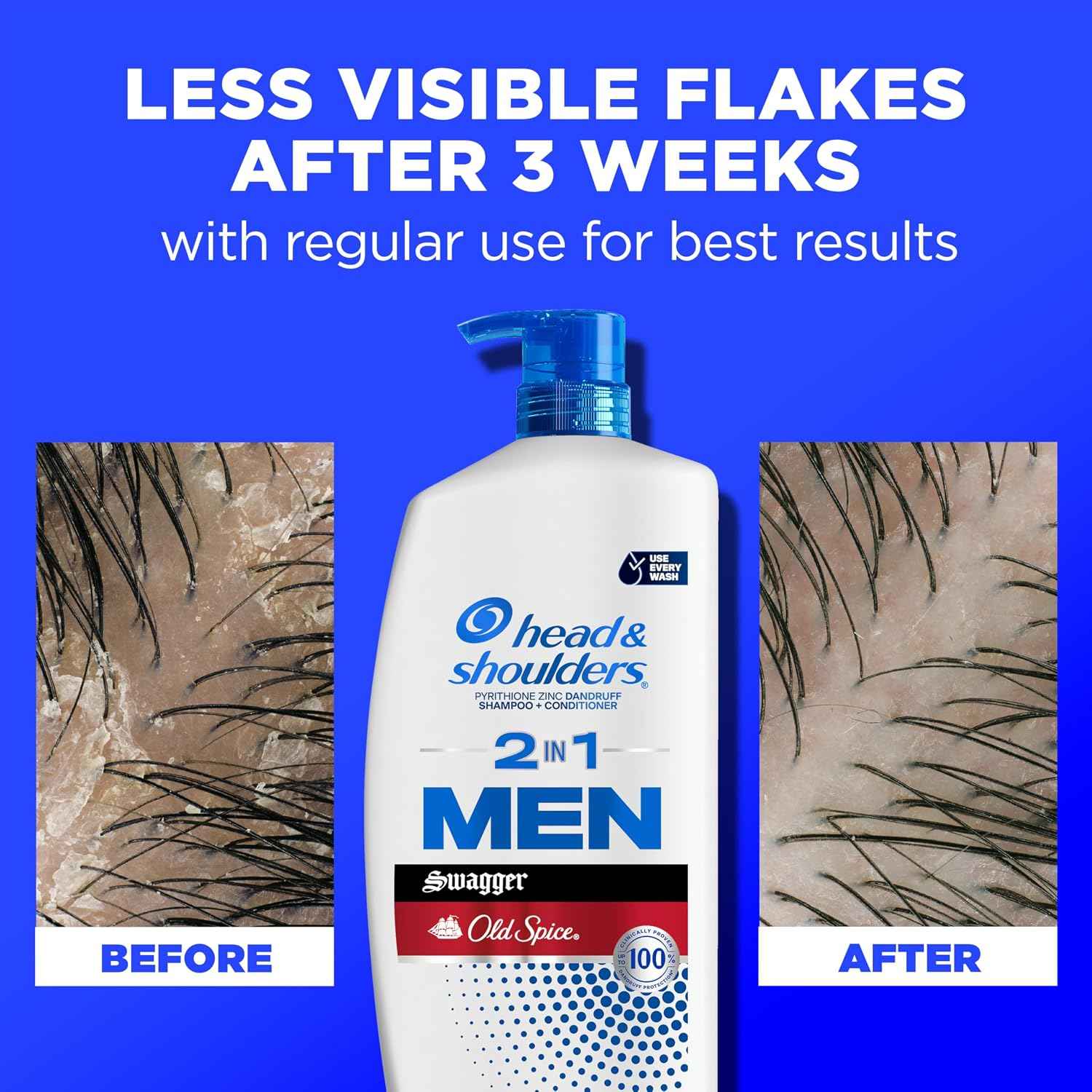 Head & Shoulders Mens 2-in-1 Shampoo and Conditioner | Old Spice Swagger | Anti-Dandruff Shampoo Value Pack for Men with 1% Pyrithione Zinc, Fights Itch & Dryness, 31.4 Fl Oz Each