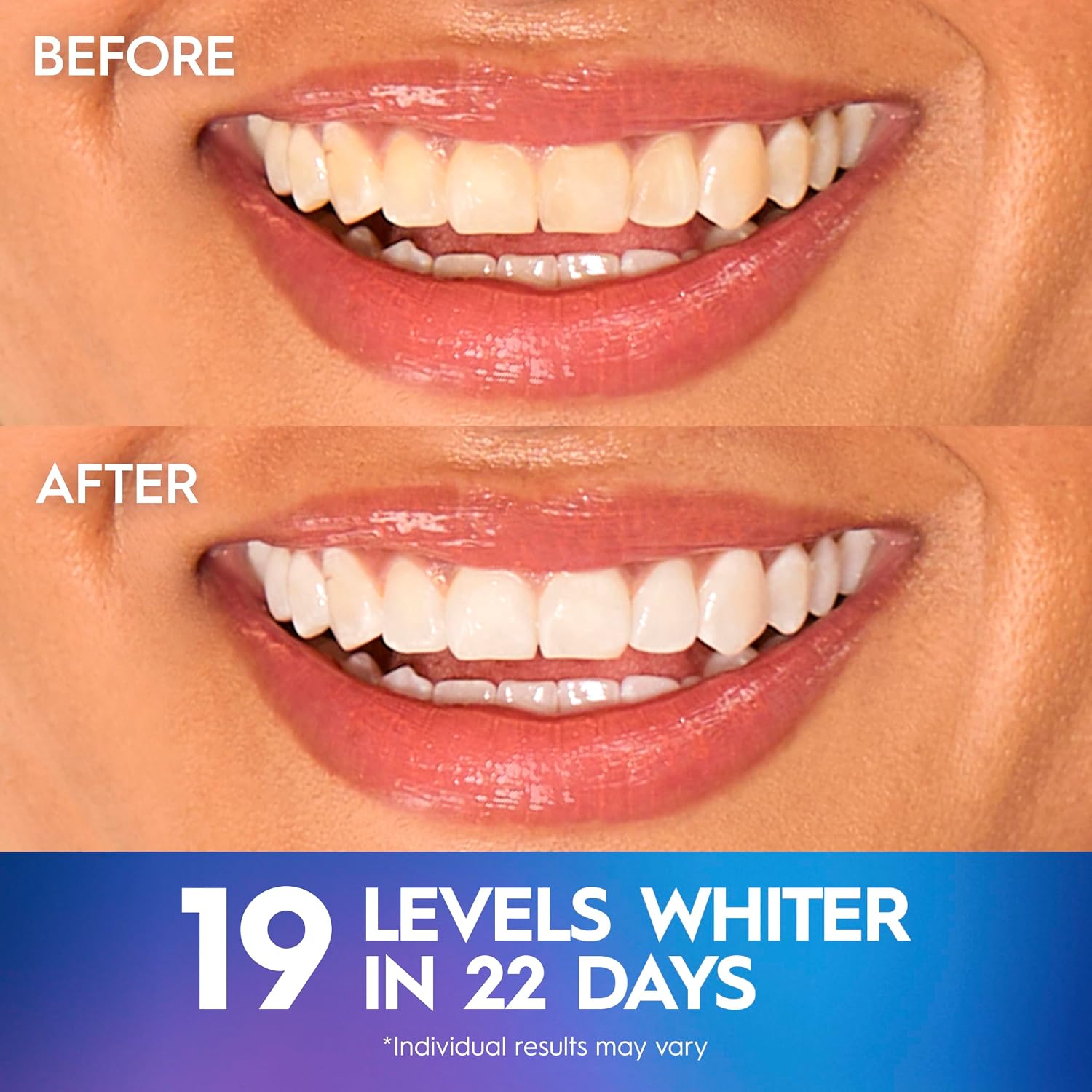 Crest Teeth Whitening Strips, Crest 3D Whitestrips Professional Effects, Enamel Safe Teeth Whitening Kit, 22 Treatments (44 Strips), Professional-Level Whitening, 19 Levels Whiter
