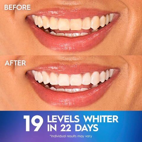 Crest Teeth Whitening Strips, Crest 3D Whitestrips Professional Effects, Enamel Safe Teeth Whitening Kit, 22 Treatments (44 Strips), Professional-Level Whitening, 19 Levels Whiter