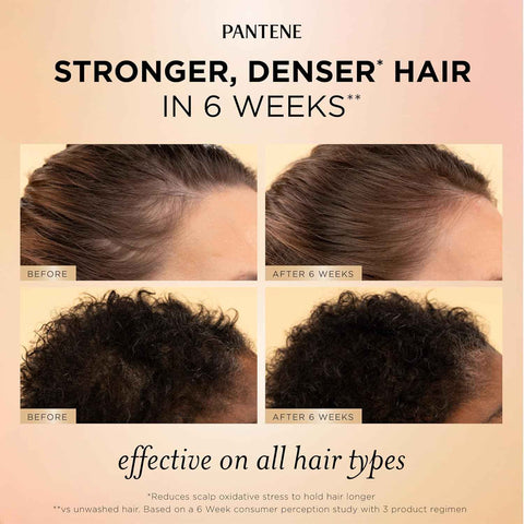 Pantene Abundant & Strong 3-Piece Regimen with B5 Complex + Niacinamide, Shampoo (13.5 oz), Conditioner (8 oz), Serum (2 oz) for Hair Loss, Thinning, Anti-Breakage, Volume - Grows Healthier