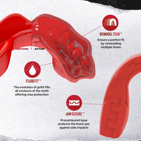SAFEJAWZ Mouth Guard, Slim Fit Mouthguard for Adult & Youth with Case