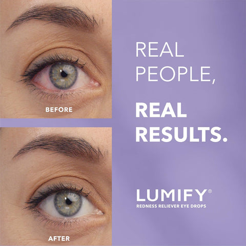 Lumify Redness Relief Eye Drops, Whiter & Brighter Looking Eyes, 0.17 oz
