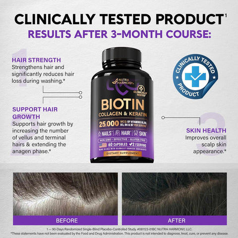 Biotin, Collagen, Hyaluronic Acid & Keratin - Hair Growth Support - 60 Caps