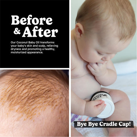 Coconut Essentials Coconut Baby Oil - Natural & Organic Moisturizer, Hair Oil for Cradle Cap Treatment, Newborn Sensitive Skin, Eczema & Psoriasis Relief, Unscented, Sunflower & GrapeSeed 4 floz