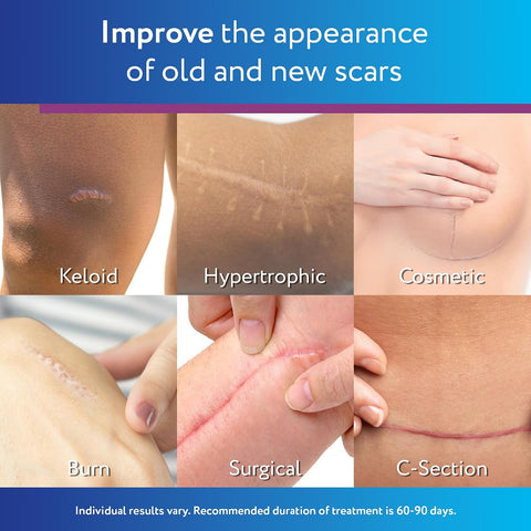 ScarAway Silicone Scar Gel, Helps Improve Size, Color & Texture of Hypertrophic & Keloid Scars from Injury, Burns & Surgery, Water Resistant, 10g (0.35 Oz)