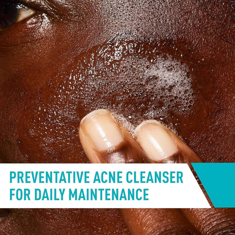 CeraVe Acne Control Cleanser, Face Wash with 2% Salicylic Acid, 16 oz