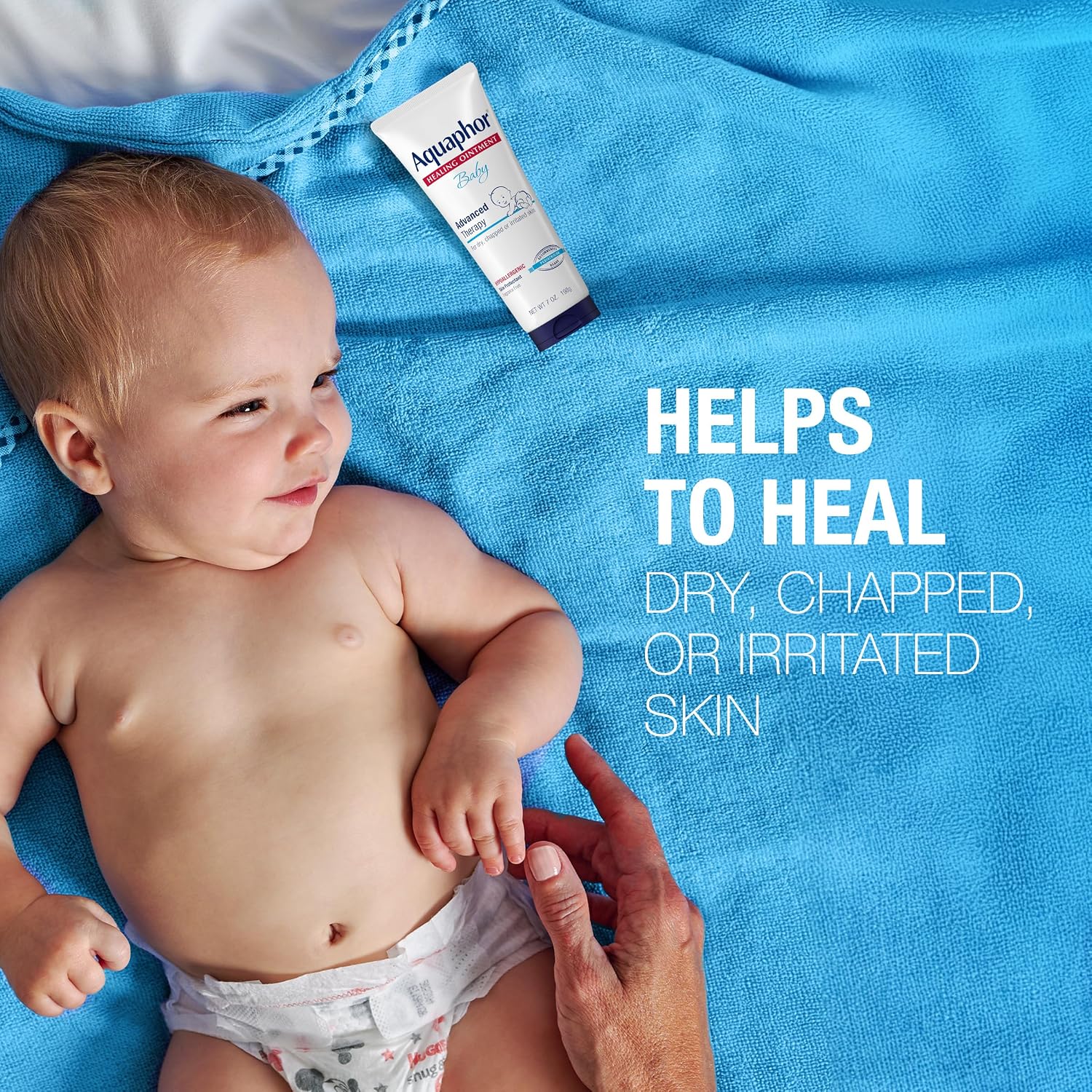 Aquaphor Baby Healing Ointment for Diaper Rash and More, 7 OZ